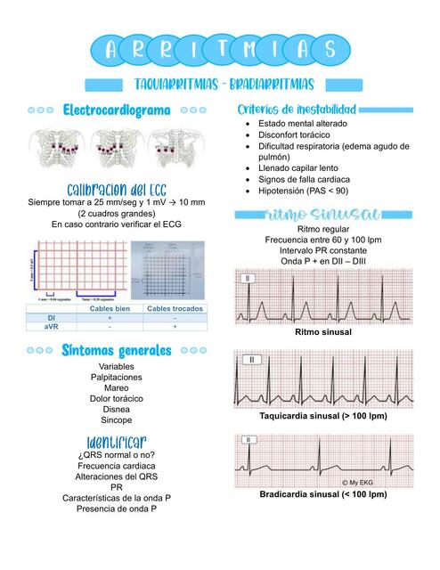 Arritmias Ana Mar A Carre O V Squez Udocz