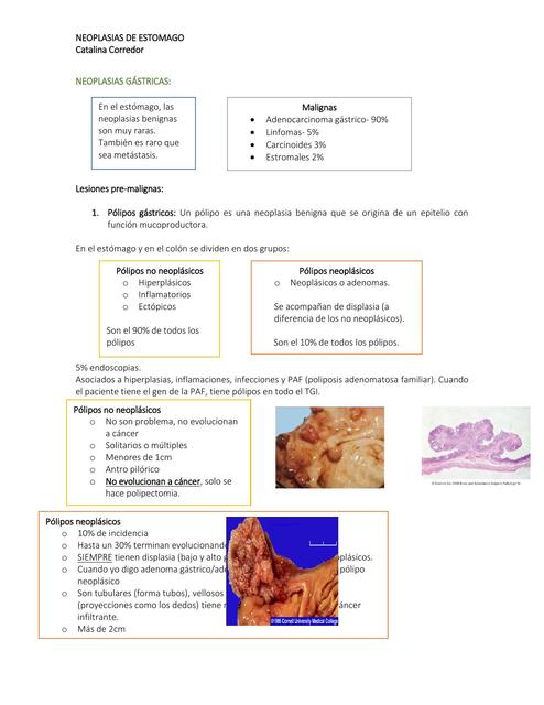 Neoplasias De Estomago Keren Usuriaga Udocz