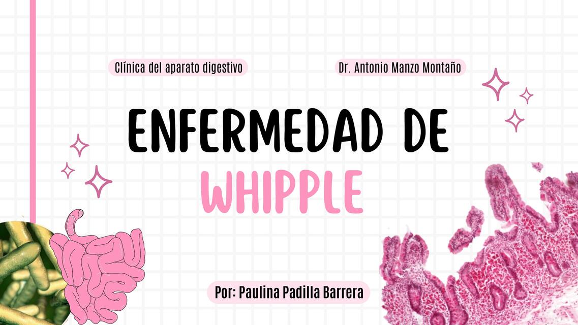 Enfermedad De Whipple 1 Pau Pa UDocz