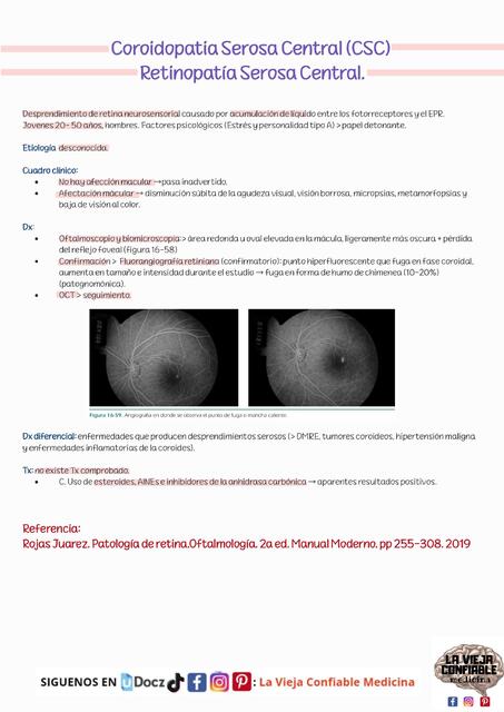 Coriopatia Serosa Central La Vieja Confiable Medicina Udocz