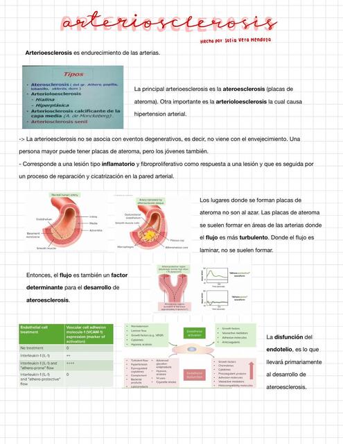 Arterioesclerosis Sof A Vera Udocz