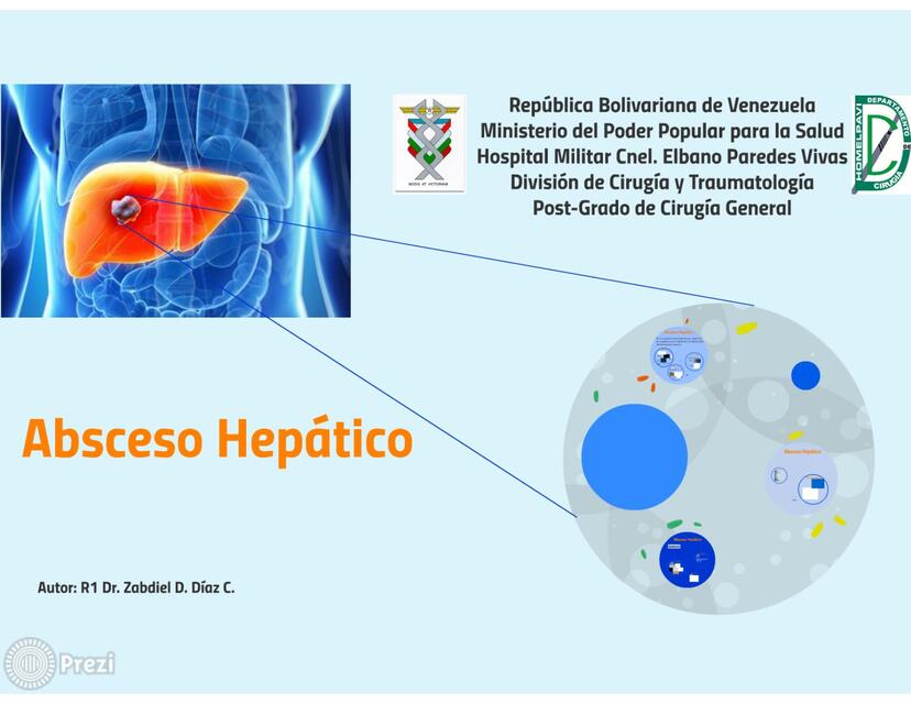 Absceso Hepatico Genesis UDocz