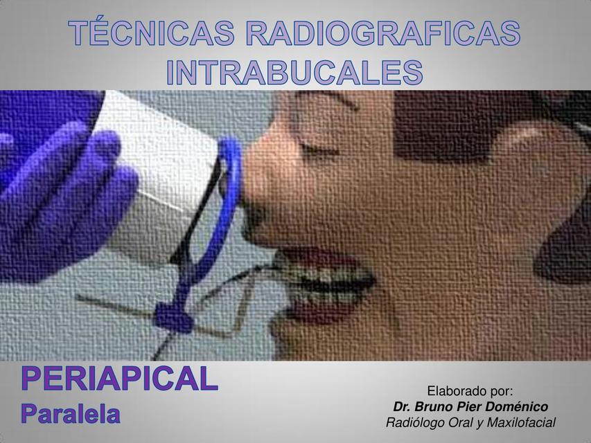 T Cnicas Radiogr Ficas Intrabucales Harry Alfonso Castiblanco Udocz