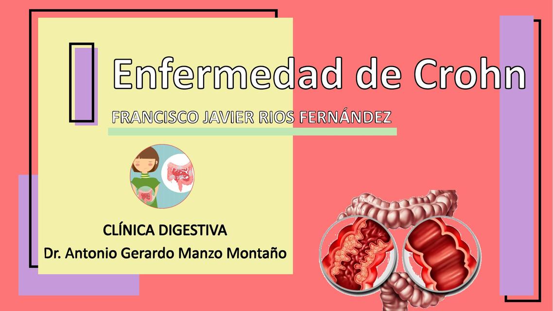 Res Menes De Cuci Y Crohn Descarga Apuntes De Cuci Y Crohn