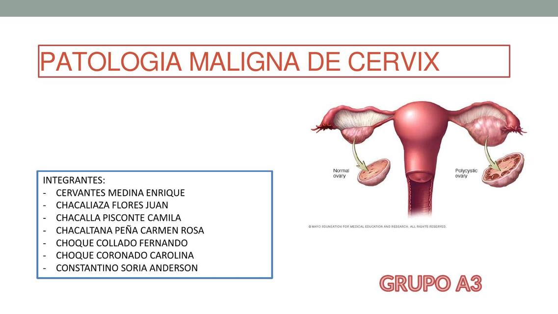 Patología Maligna de Cuello Uterino DRA GARCIA GUTIERREZ JULIA G uDocz