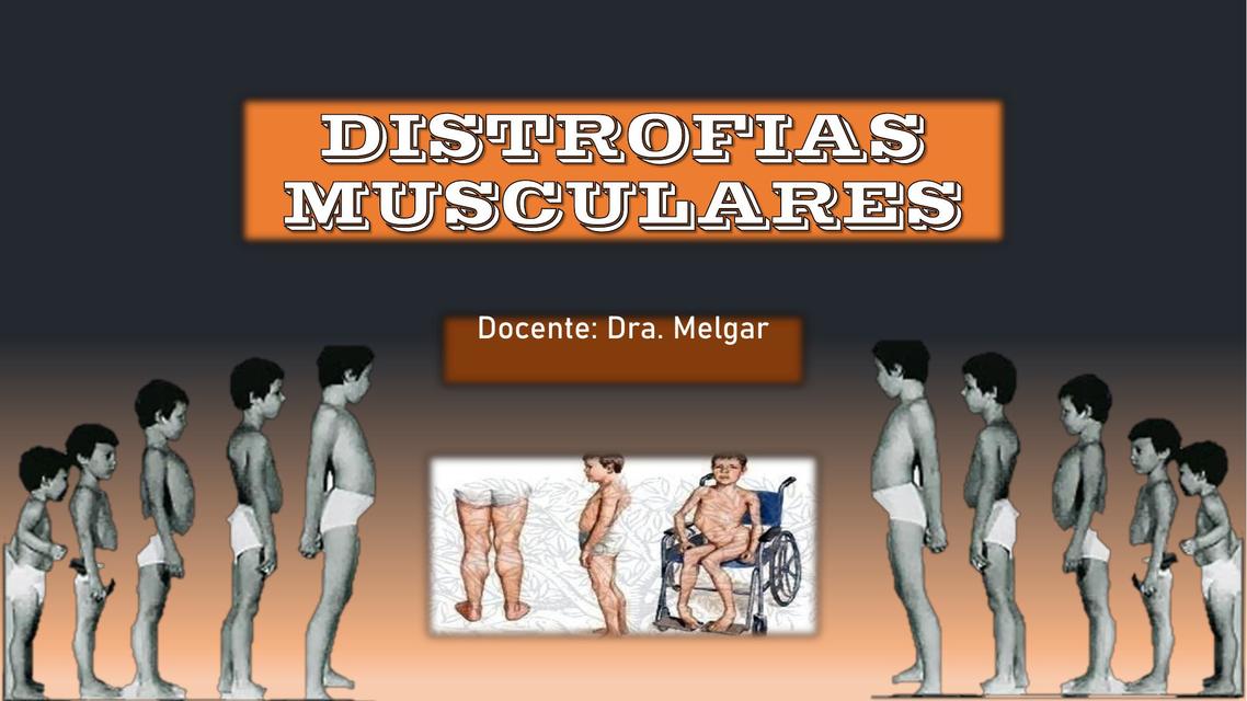 Distrofia Muscular C Mo Se Detecta S Ntomas Y Factores De Riesgo