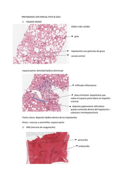 Preparados De Patologia Para El 1er Parcial Karine Bacellar UDocz