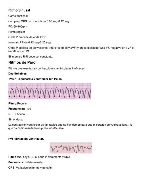 Ritmos De Paro Y Trauma Udocz