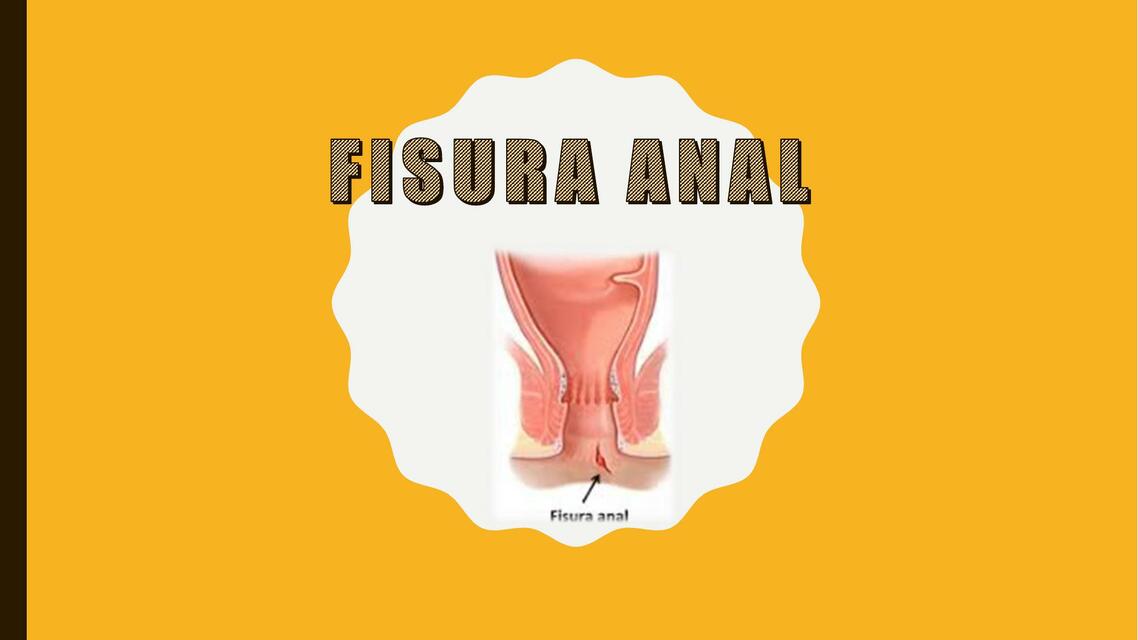 Fisura Anal Esther Saona UDocz