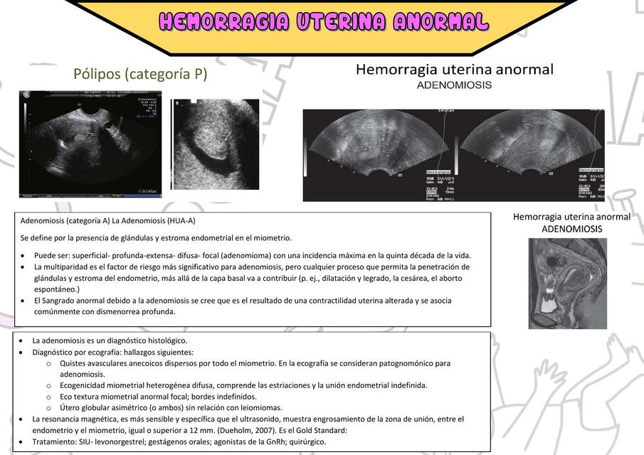 Hemorragia Uterina Anormal UDocz 4096 The Best Porn Website