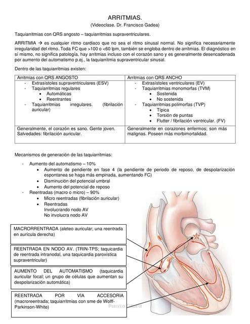 Arritmias Pamela Odiard Udocz