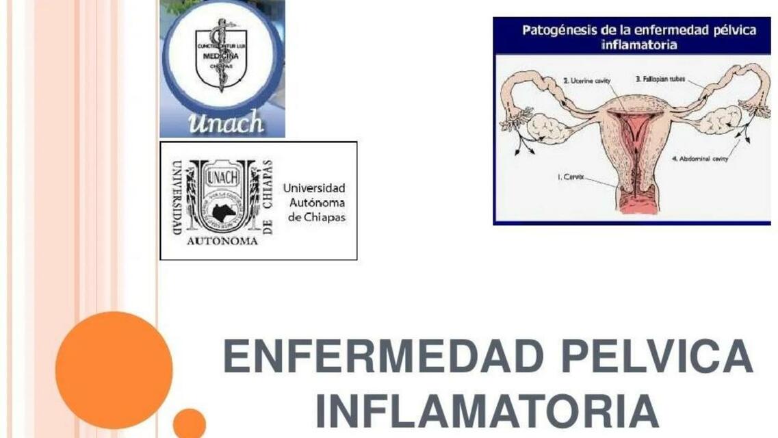 Enfermedad Pélvica Inflamatoria Rosa Gómez uDocz