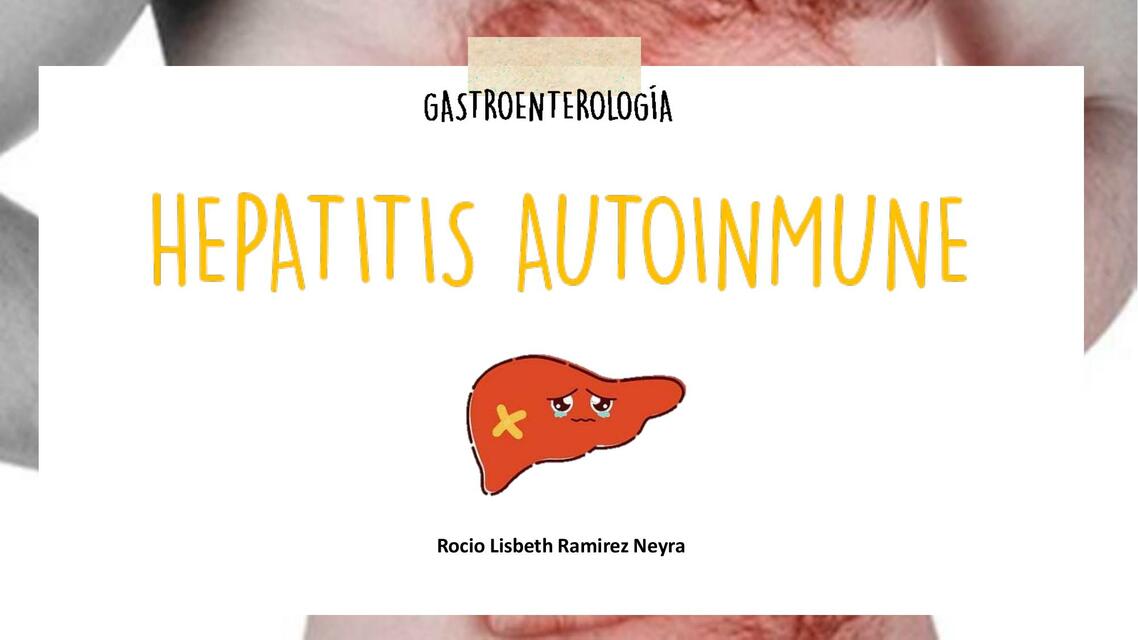 Hepatitis Autoinmune Rocio Ramirez UDocz