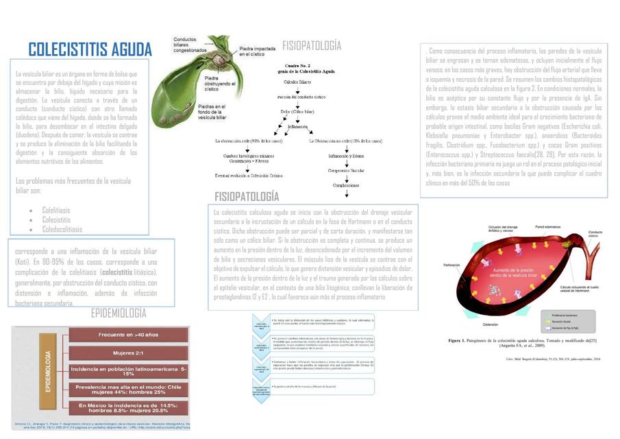 Colecistitis Aguda ALTRUUS UDocz