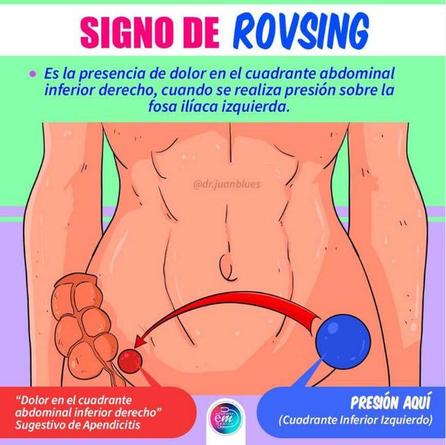 Signo De Rovsing YUDOC ORG UDocz