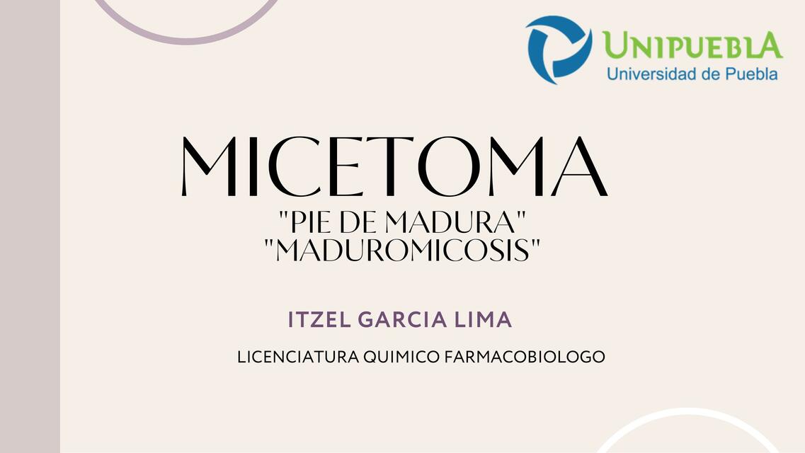 Micetoma Itzel Garcia UDocz