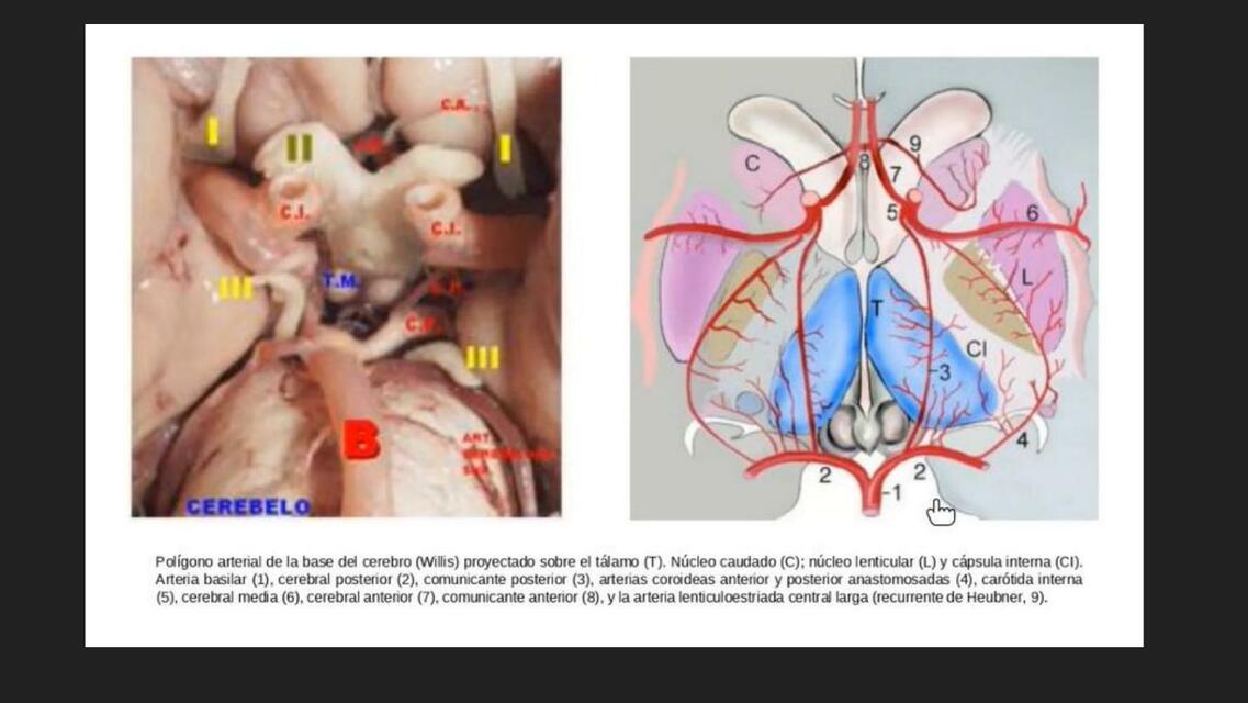 Conformaci N Del Pol Gono Arterial Del Cerebro Bosque Udocz