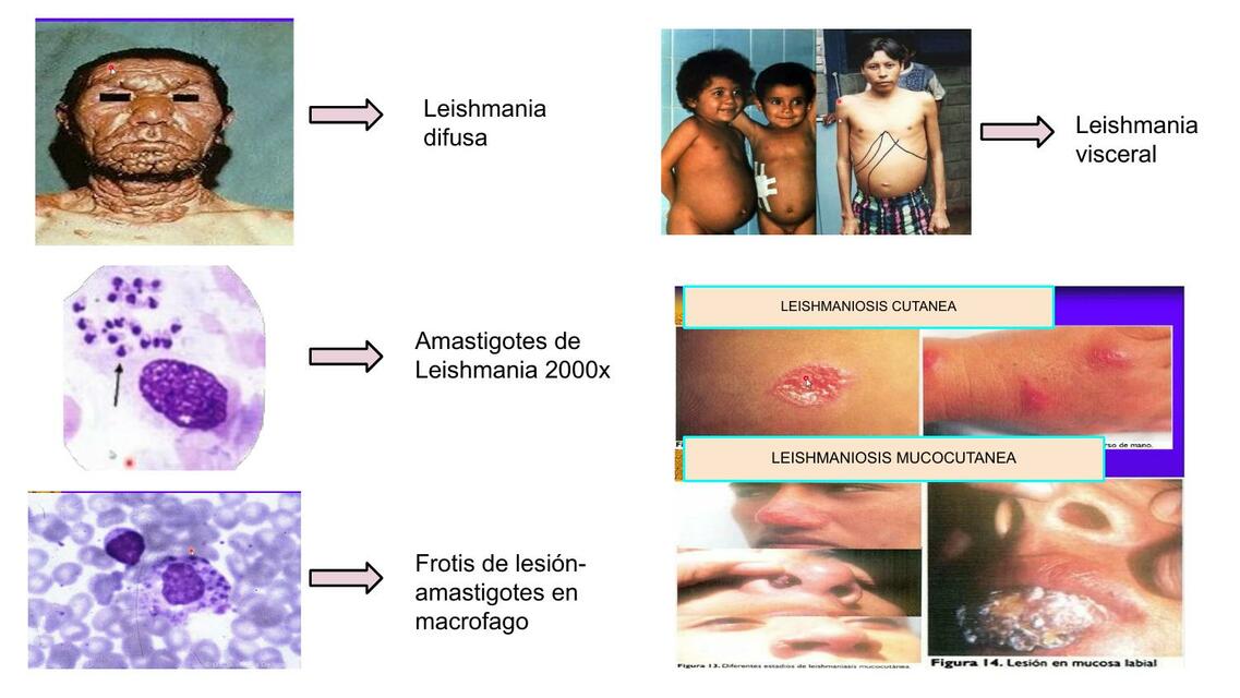 Tarjeta De Parasitolog A Bosque Udocz