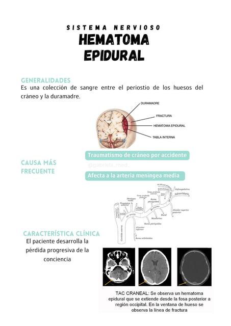 Hematoma Epidural Maryuri Lisbeth Udocz