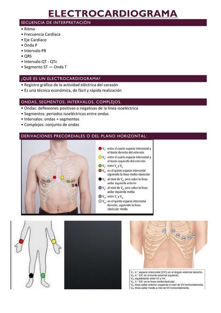 Electrocardiograma Estudiando En La Uner Udocz