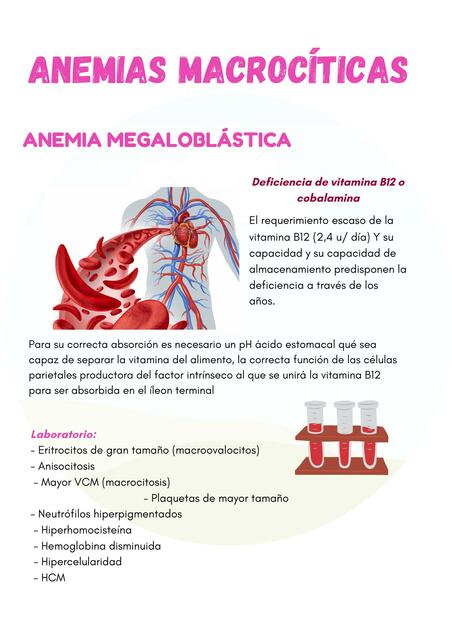 Anemias macrocíticas MARYURI LISBETH uDocz