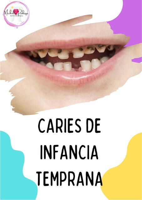 Caries De Infancia Temprana Michelle Pedroza Udocz