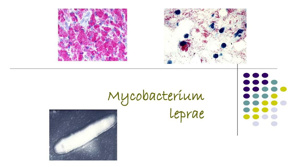 Mycobacterium Leprae CIENCIAS DE LA SALUD UDocz