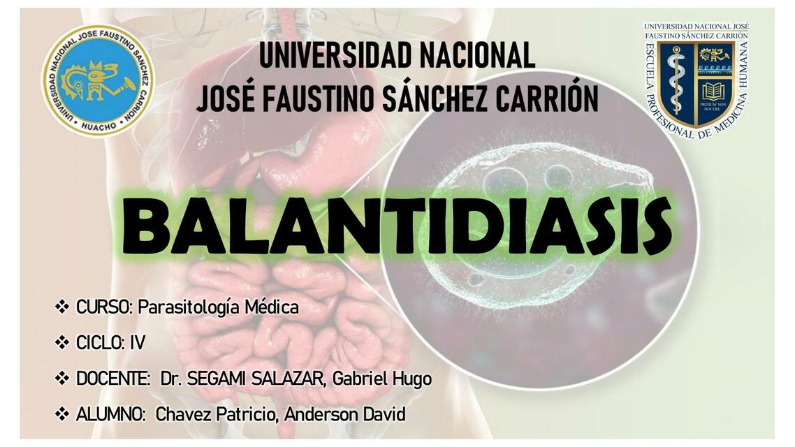 Balantidiasis Parasitosis Intestinales Anderson Chavez Patricio UDocz