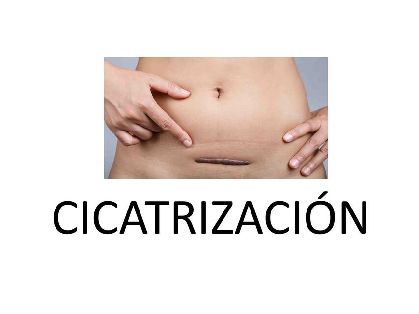 Cicatrización Lisette ResuMedIqObste uDocz