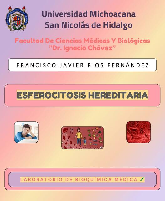 Esferocitosis Hereditaria Javier Rios UDocz