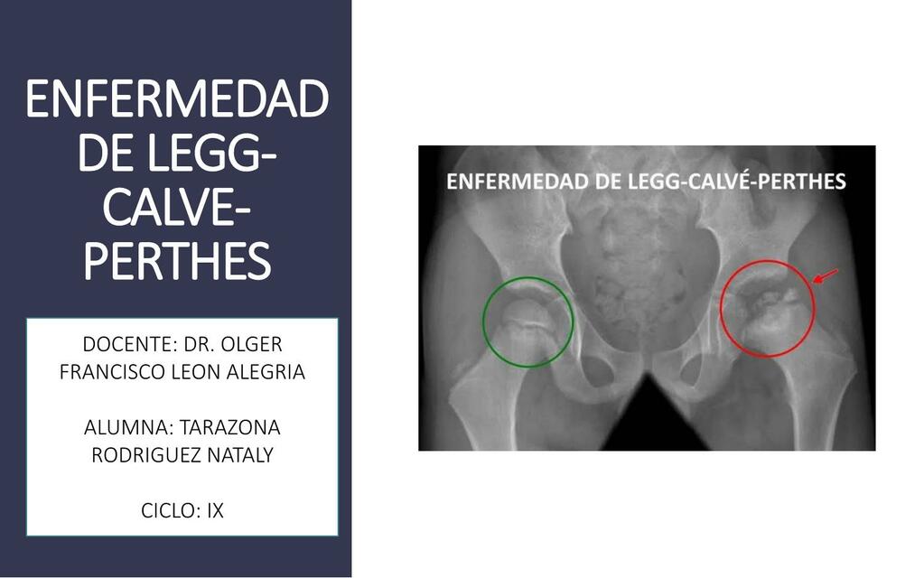 Res Menes De Radiograf A De Cadera Descarga Apuntes De Radiograf A De