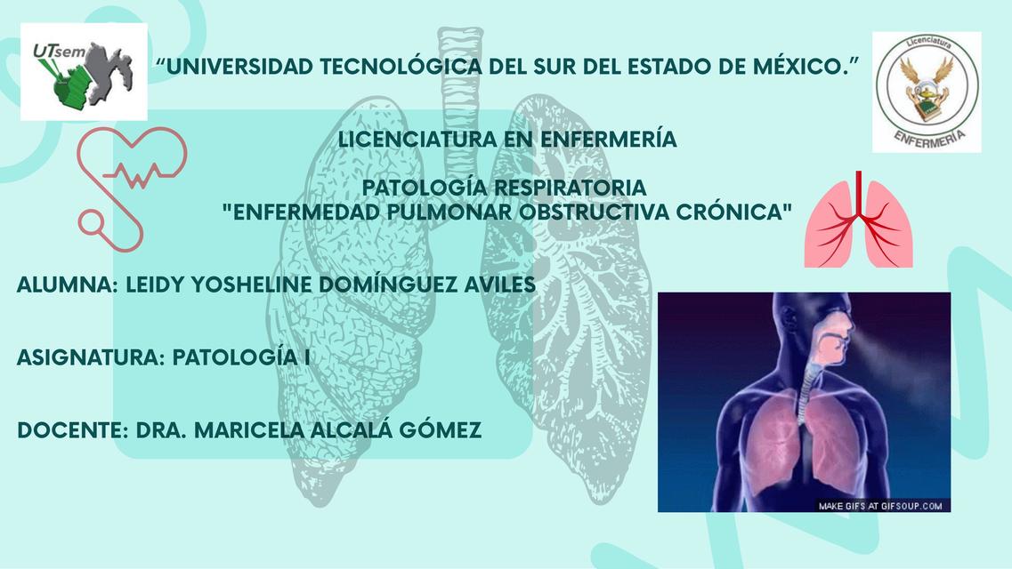 Enfermedad Pulmonar Obstructiva Cr Nica Yossh Domavil Udocz