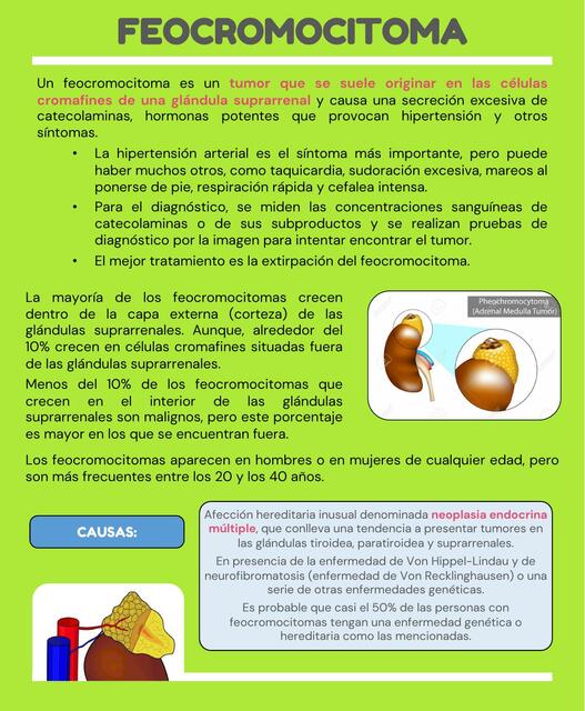 Feocromocitoma Javier Rios Udocz