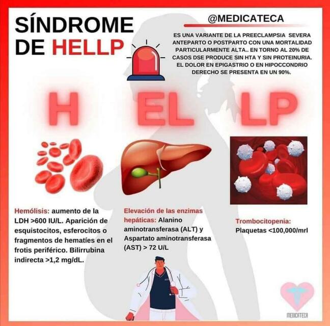 Sindrome De Hellp YUDOC ORG UDocz