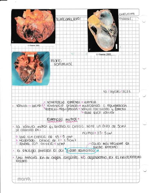 Lesiones Card Acas Valvulares Patolog A Aleja Huertas Udocz