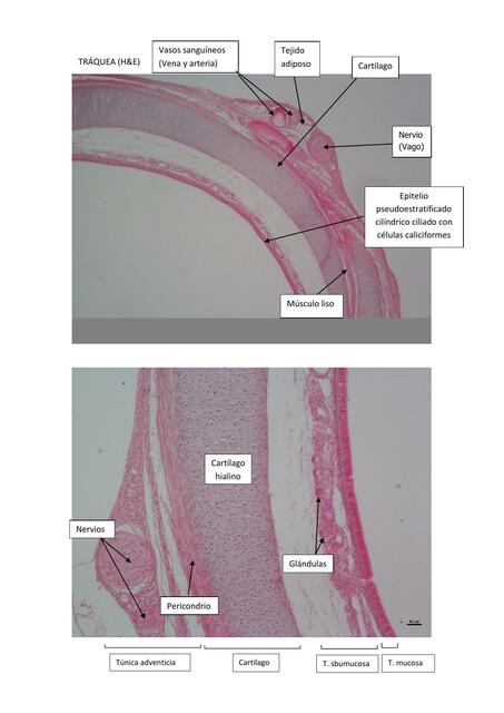 Histología Sistema Respiratorio Julieta uDocz