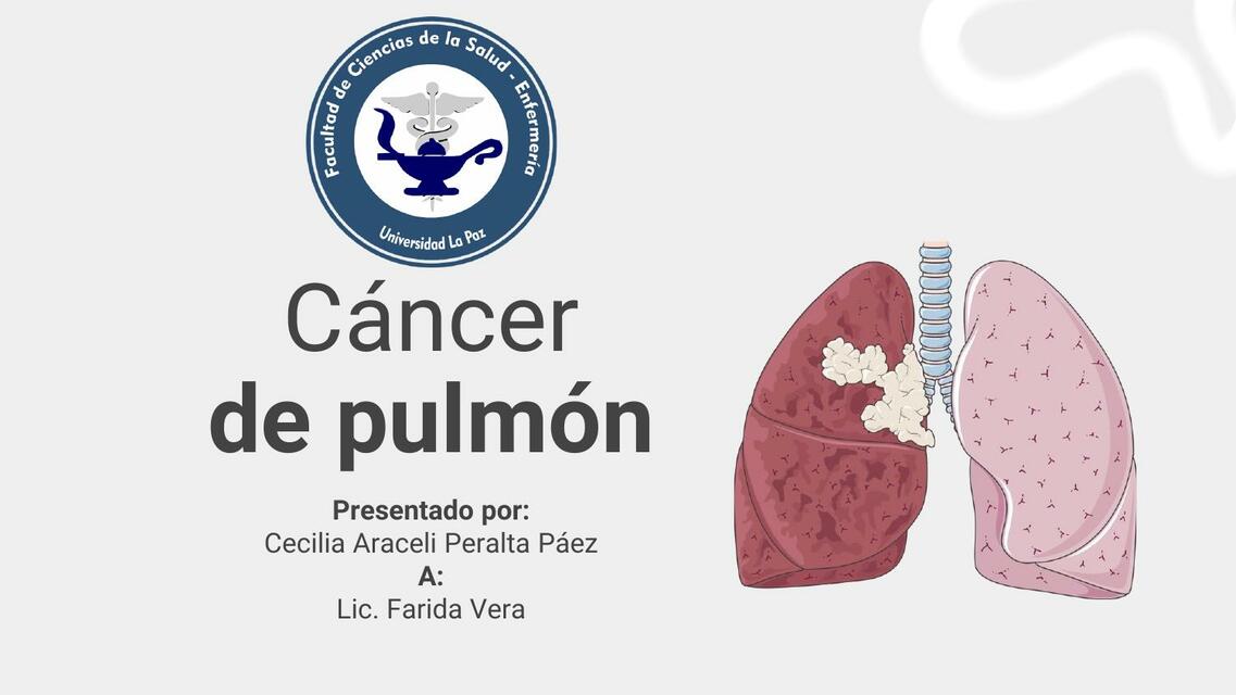 Cáncer de Pulmón Monse Gauto uDocz