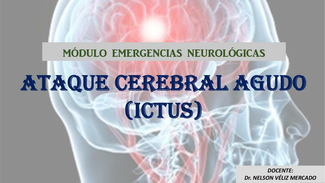 Ataque Cerebral Agudo ICTUS Teresa UDocz