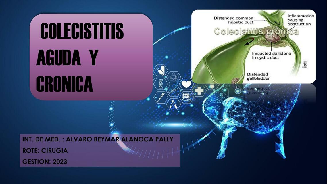 COLECISTITIS AGUDA Y CRONICA Álvaro Alanoca uDocz