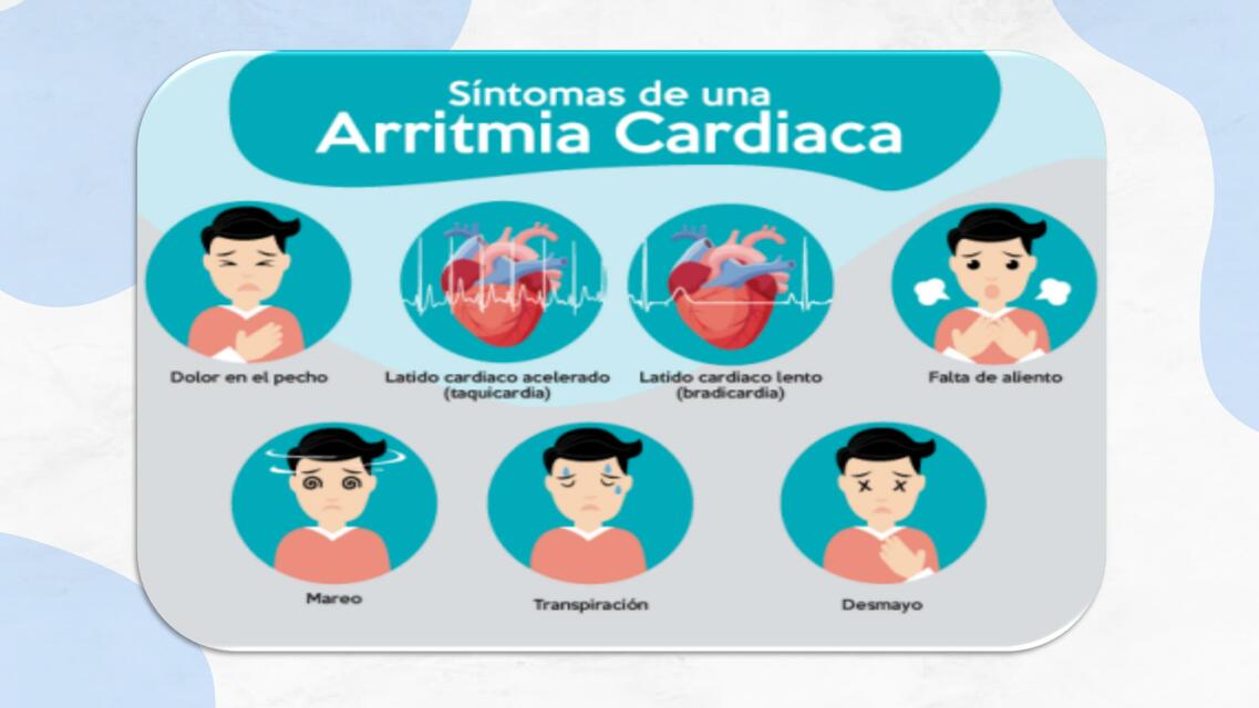 Arritmia Cardiaca Alxnsx S Udocz