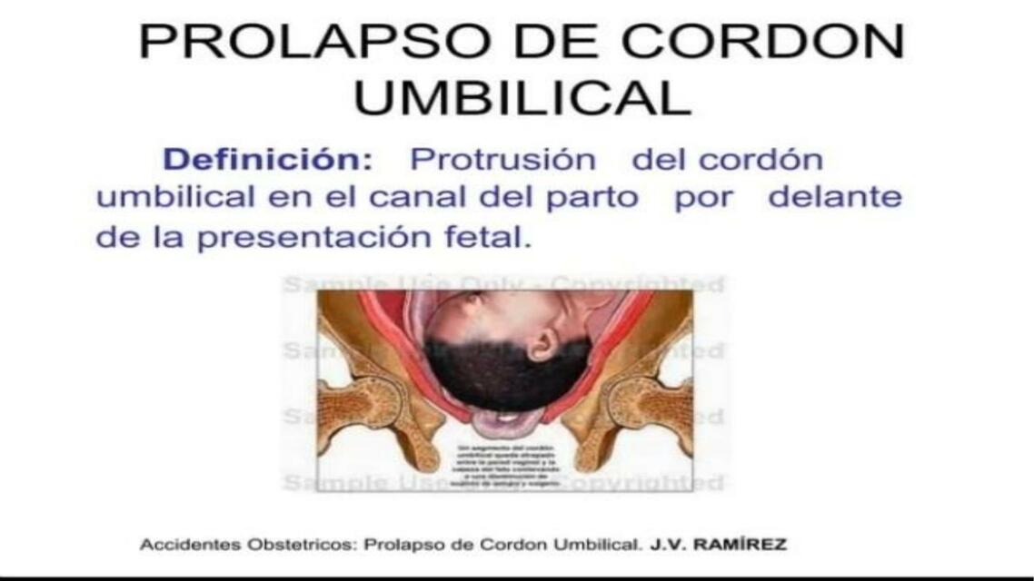 Prolapso De Cord N Umbilical Escuela Medica Udocz