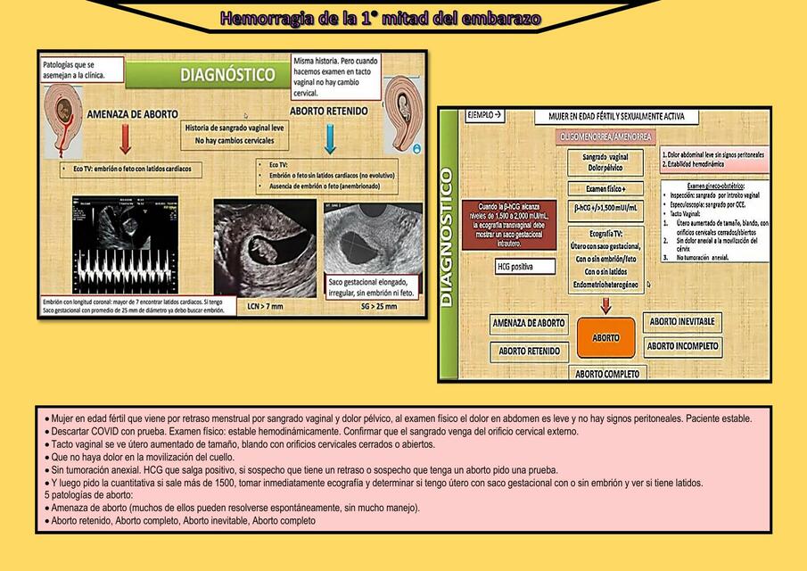 Diagnóstico Amenaza de Aborto y Aborto Retenido Mishelle Chavez uDocz