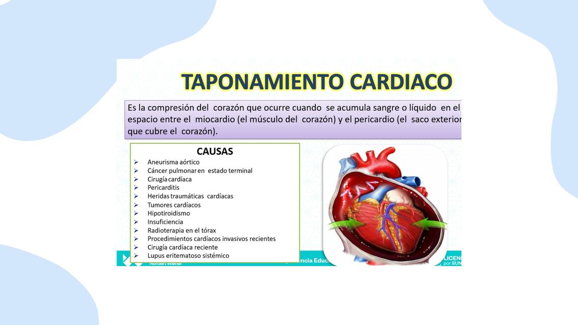 Tratamiento Cardiaco Alxnsx S UDocz