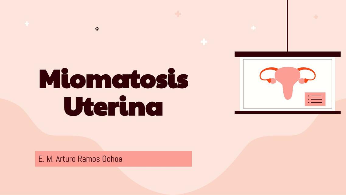 Miomatosis Uterina Arturo Ramos UDocz