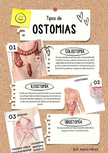 Tipos de Ostomías María Pérez uDocz