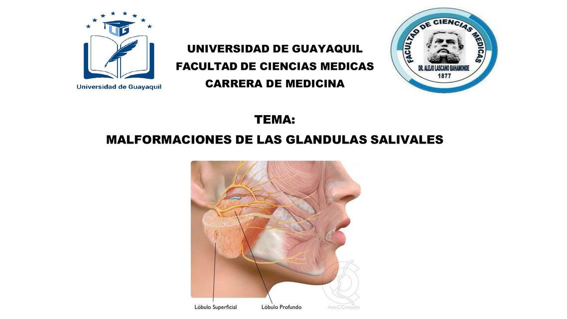 MALFORMACIONES DE LAS GLANDULAS SALIVALES Ronaldo Montalvo Oñate uDocz