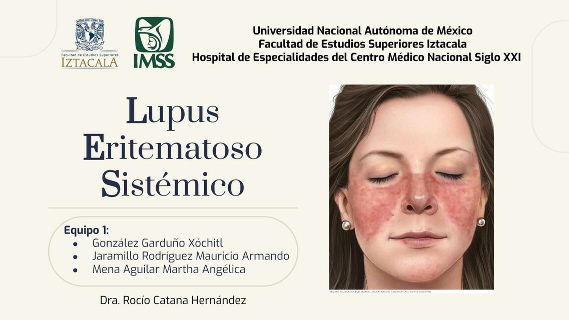 Lupus Eritematoso Sist Mico Ang Lica Mena Udocz