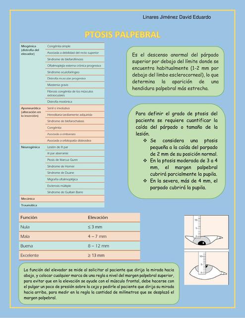 Clasificaci N De La Ptosis Palpebral Iovanny Cruz Ojeda Udocz