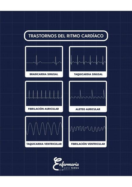 Trastornos Del Ritmo Card Aco Mar A Jos Gomes Enfermeriaparatodos