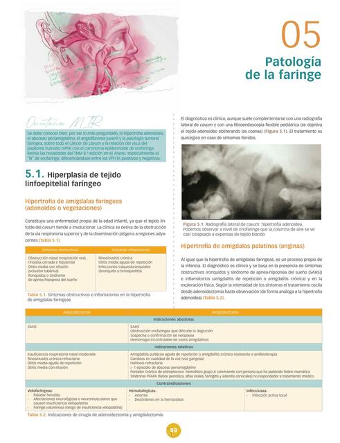 Patología de la faringe Full ciencia uDocz